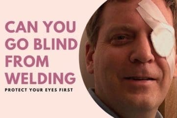 Can You Go Blind From Welding | Protect Your Eyes First % Can You Go Blind From Welding