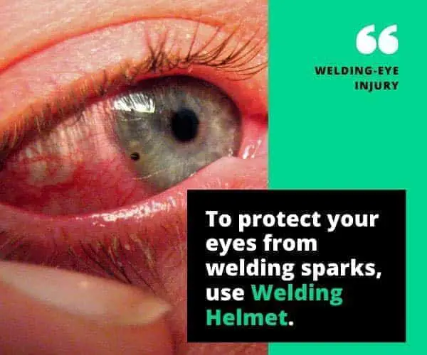 Can You Go Blind From Welding | Protect Your Eyes First % welding eye injury